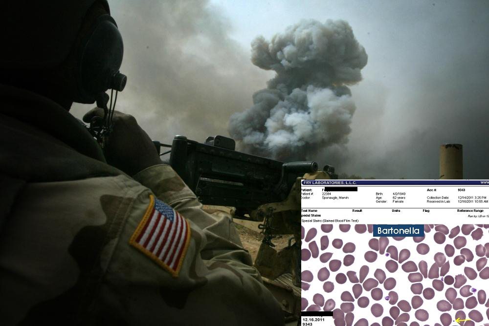 Iraq war and the surge of bartonella infections in america.
