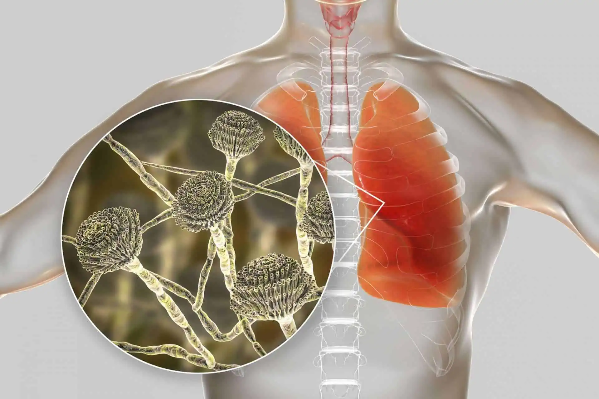 Can mold grow in your lungs?