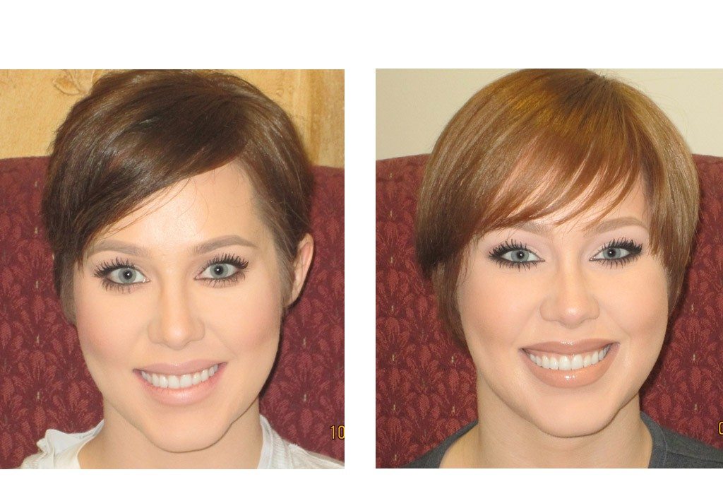 Stacia texas depression treatment